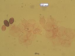 Coprinellus bisporus