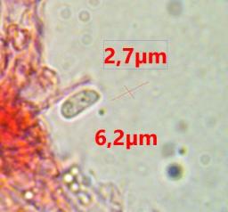 Sistotrema sernanderi