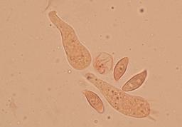 Lepiota oreadiformis