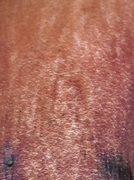 Neoboletus erythropus