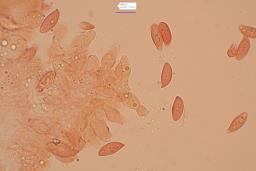 Lepiota oreadiformis