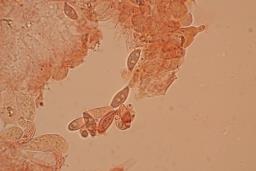 Lepiota oreadiformis