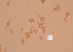 Byssomerulius corium