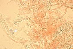 Hymenoscyphus imberbis