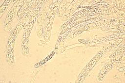 Hymenoscyphus imberbis