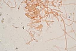 Resupinatus striatulus