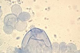 Mycena metata