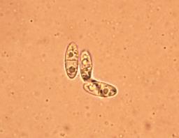 Calycina citrina