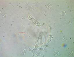 Platygloea disciformis