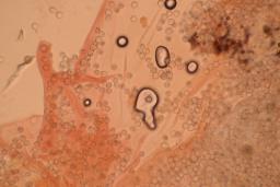 Arcyria denudata