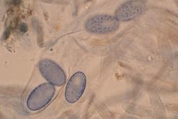 Scutellinia scutellata