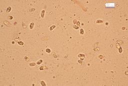 Pseudotricholoma metapodium