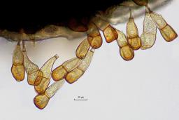 Puccinia allii