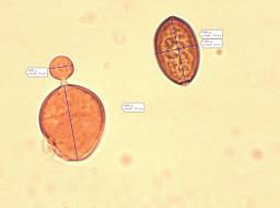 Conocybe alboradicans