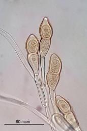 Puccinia teucrii
