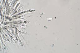 Neonectria punicea