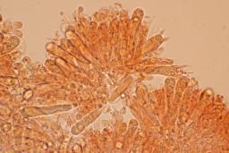 Pseudoporpoloma pes-caprae