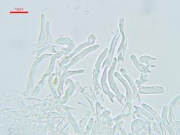 Orbilia pseudoaristata