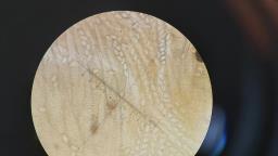 Lasiobolus ciliatus