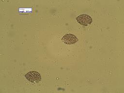 Calonarius elegantissimus