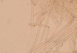 Lepiota oreadiformis