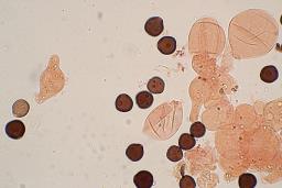 Narcissea cordispora