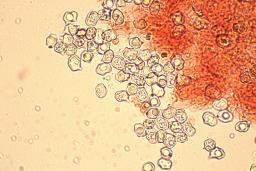 Entoloma undulatosporum