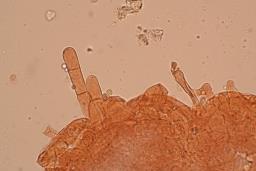 Callistosporium luteo-olivaceum