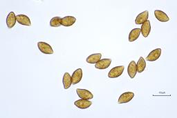 Phlegmacium balteatocumatile