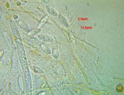 Hymenoscyphus eichleri