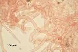 Infundibulicybe trulliformis