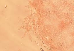 Byssomerulius corium