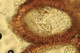 Neonectria punicea