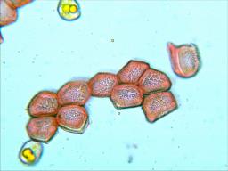 Puccinia urticata