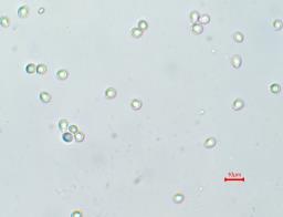 Vanderbylia fraxinea