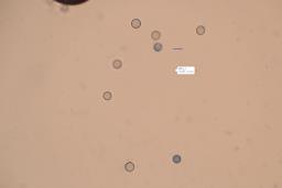 Apioperdon pyriforme