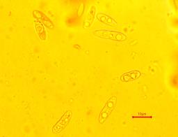 Calycina citrina