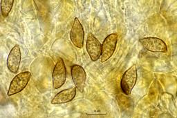 Cortinarius collinitus