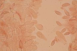 Lepiota oreadiformis