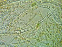 Hymenoscyphus eichleri