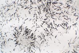 Xylaria longipes