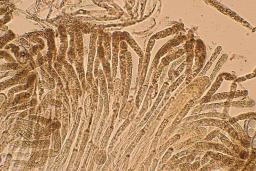 Psilopezia nummularia