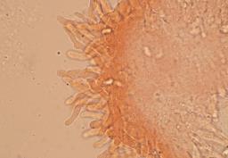Pseudotricholoma metapodium