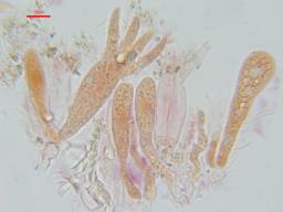 Heteroradulum kmetii