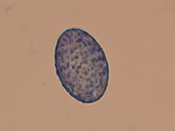 Scutellinia nigrohirtula