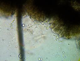 Colletotrichum