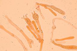 Hygrophorus hyacinthinus