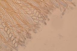 Scutellinia scutellata