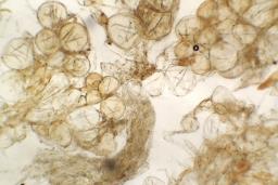 Peziza vesiculosa