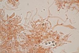 Resupinatus striatulus